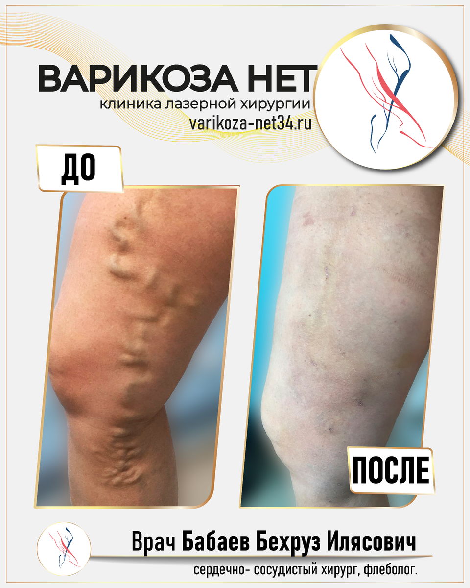 Foto - Eigentum der Klinik Varikoza net Wolgograd. Jegliches Kopieren ist untersagt.