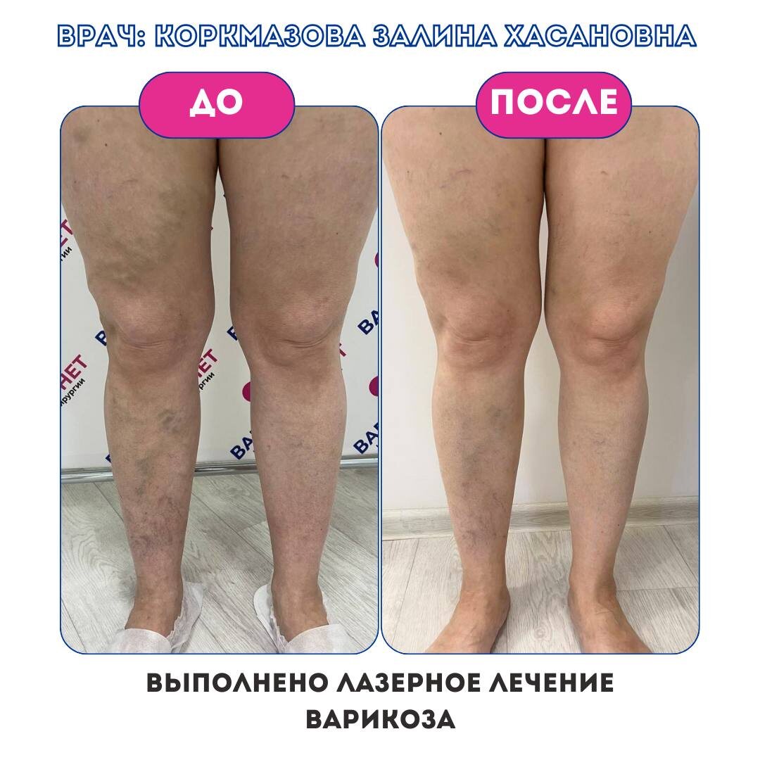 Untersuchung der Beine