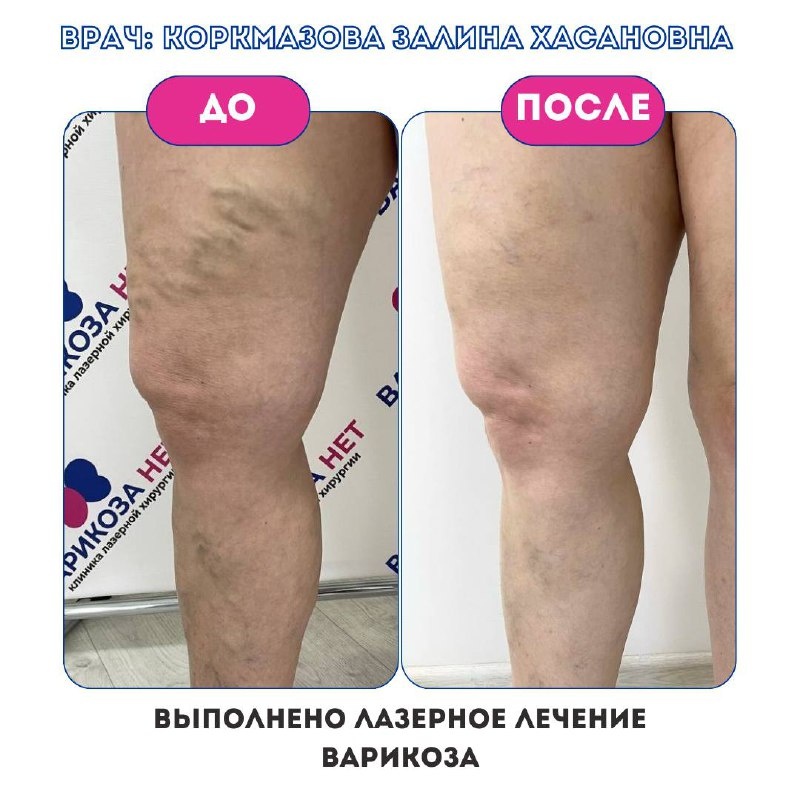 Prävention und Sport