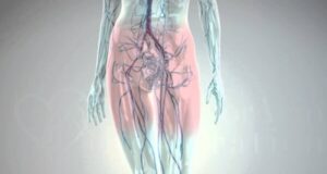 Krampfadern im kleinen Becken: Symptome, Ursachen und effektive Behandlung