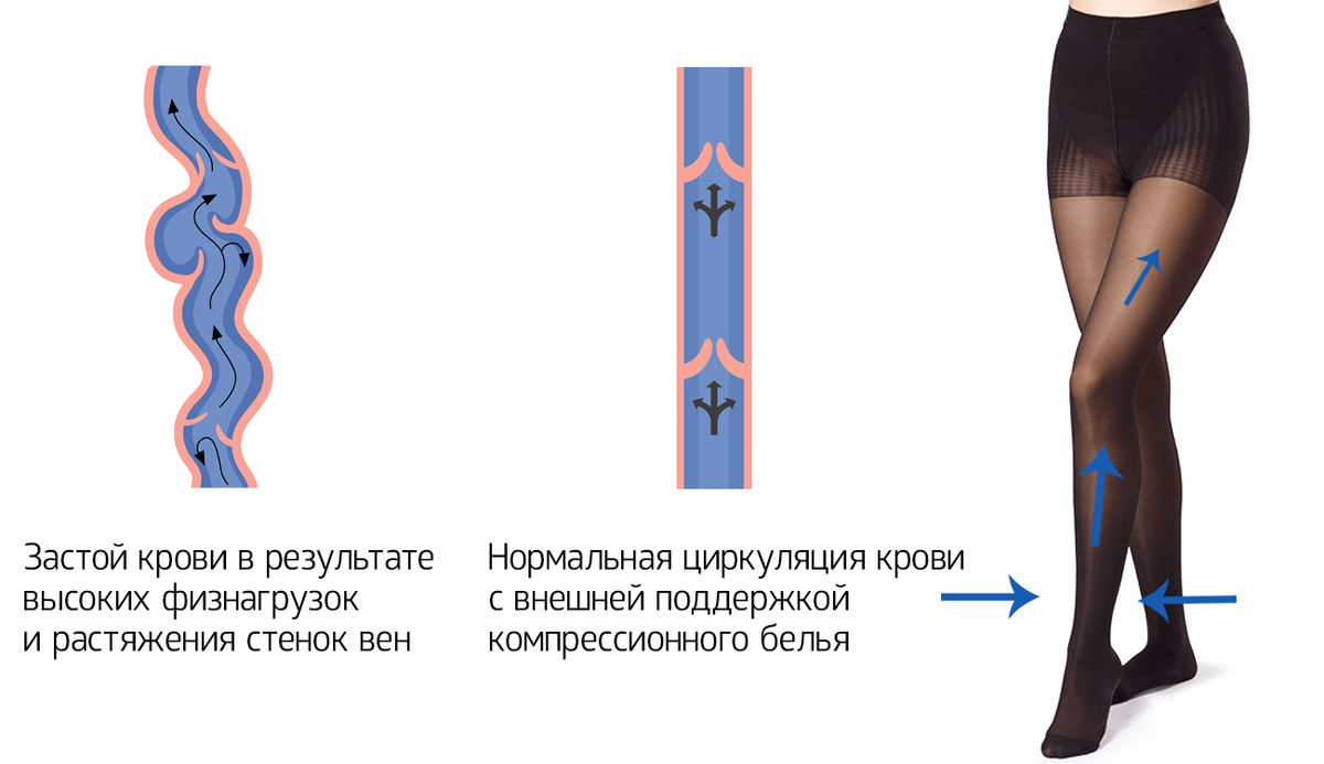 Kompressionsstrümpfe - 3