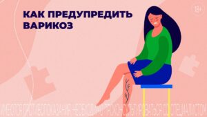 Alles über Krampfadern: Ursachen, Symptome und wie Sie effektiv vorbeugen können