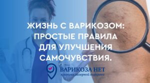 Krampfadern Symptome: Wie man die Krankheit erkennt und effektiv behandelt