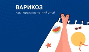 Tipps gegen Krampfadern im Sommer: So bleiben Ihre Beine gesund