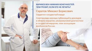 Ursachen, Symptome und Behandlung von Krampfadern: Ein umfassender Ratgeber